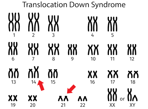 Translocation