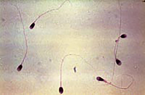 Sperm.