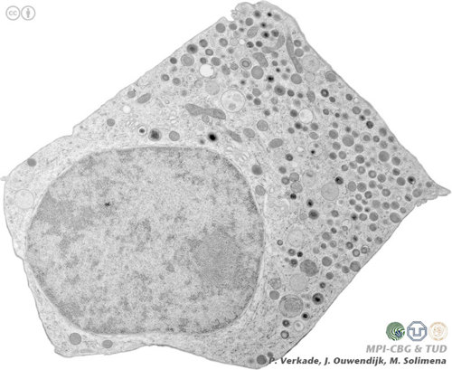 Beta cell.