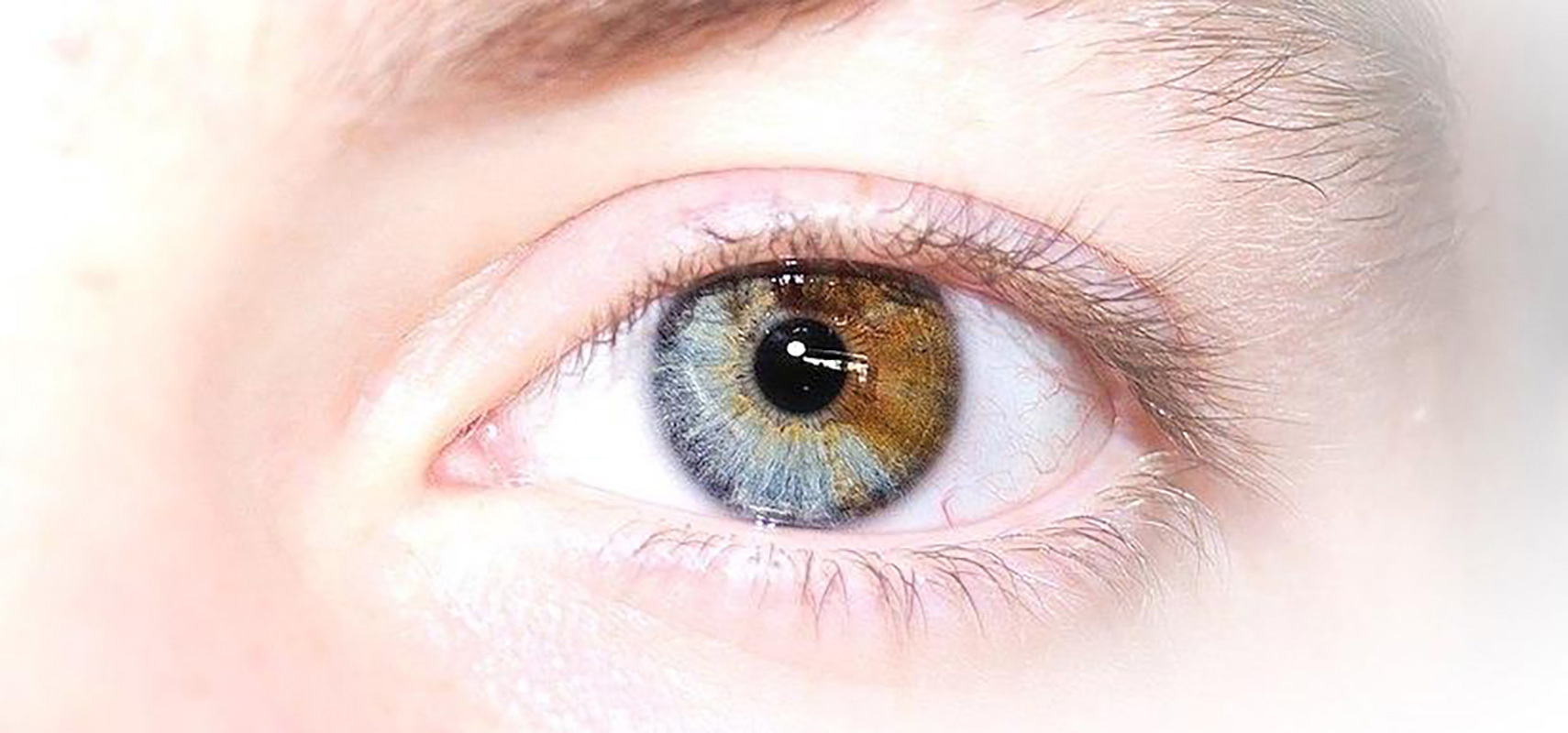 human chimera eyes
