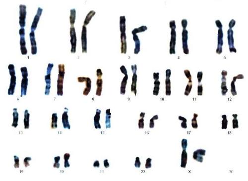 Human karyotype